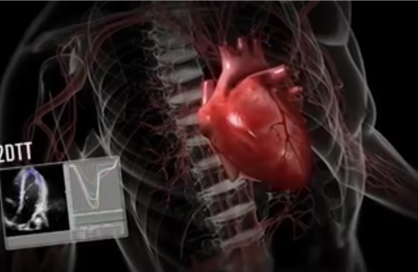 Hitachi Healthcare Solution