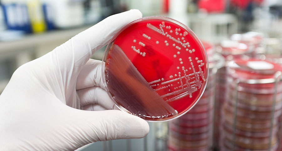 Disease Control and Prevention