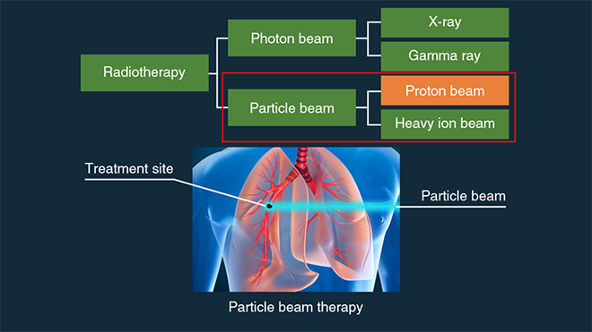 Particle Therapy System
